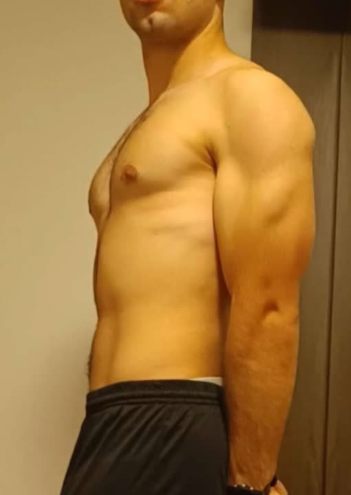 Unai, antes